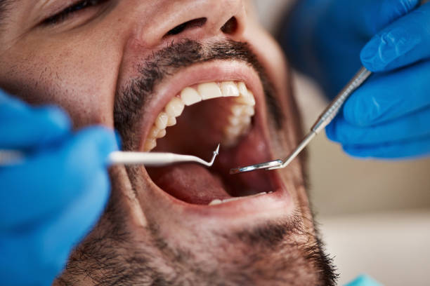 Best Emergency Broken Tooth Repair in Ruch, OR
