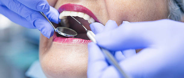 Best Emergency Treatment for Toothache in Ruch, OR